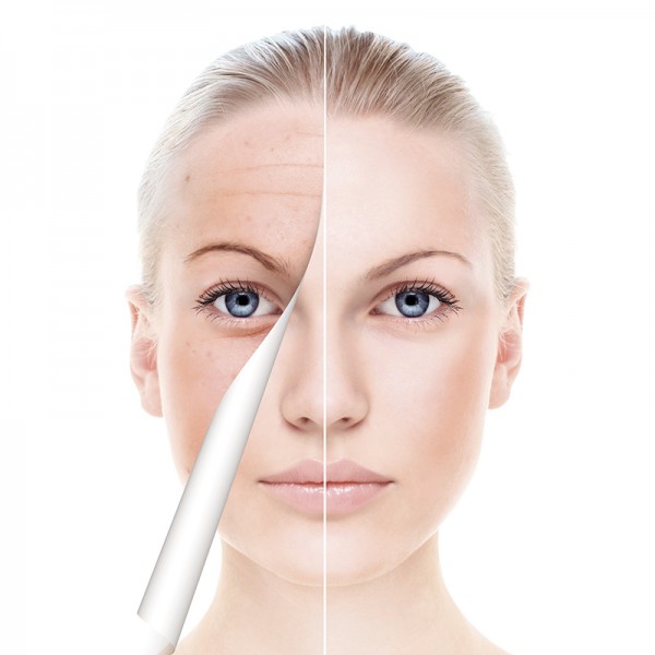 Micro Needling